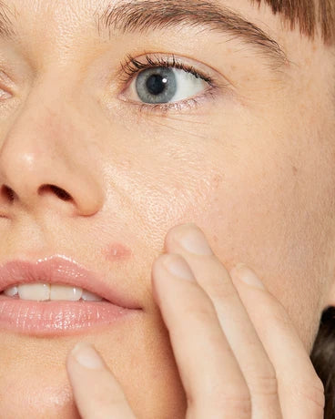 Dermalogica Deep Breakout Liquid Patch - Exquisite Laser Clinic