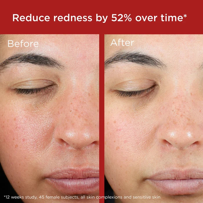 Elta MD sunscreen EltaMD UV Skin Recovery Broad Spectrum SPF 50 Face Sunscreen - Untinted