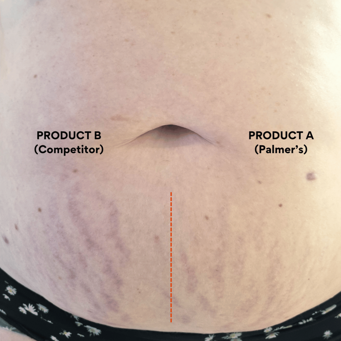 Palmer's Massage Lotion for Stretch Marks 250ml