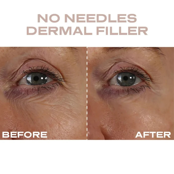Plump It No Needles Derma Filler Pods Starter Kit with 15 x 10ml skin care pods, showcasing the product packaging and individual pods.