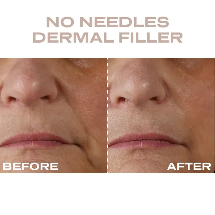 Plump It No Needles Derma Filler Pods Starter Kit with 15 x 10ml skin care serum bottles in sleek packaging