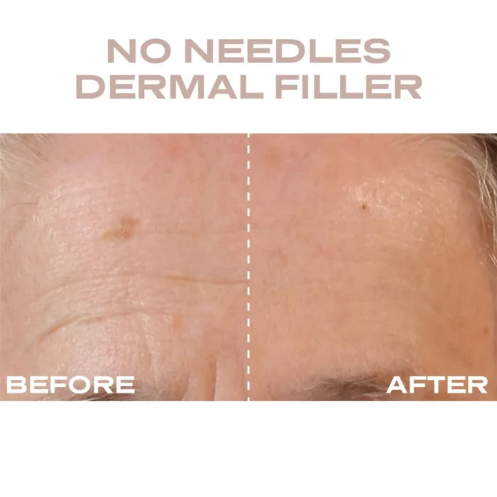 Plump It No Needles Derma Filler Pods Starter Kit featuring 15 x 10ml skin care pods arranged on a display tray.