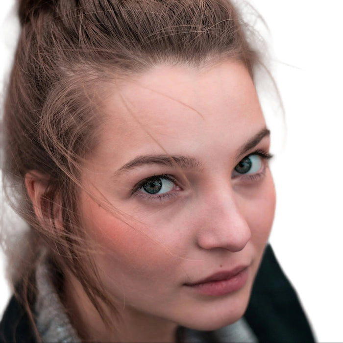 White woman brown hair rosy cheeks. Best cream for rosacea redness relief.  Dermal Essentials Medical Grade Skincare.
