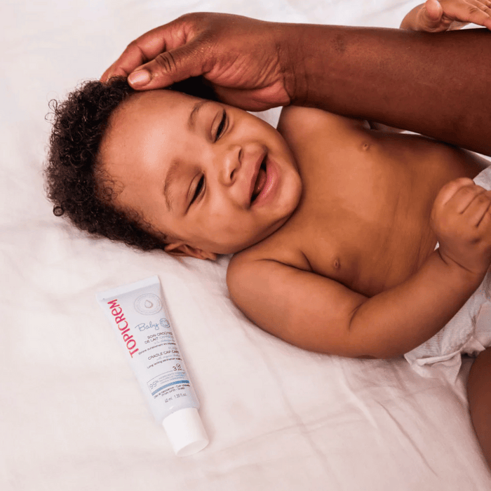 Topicrem Baby Flash Cradle Cap Care 40ml